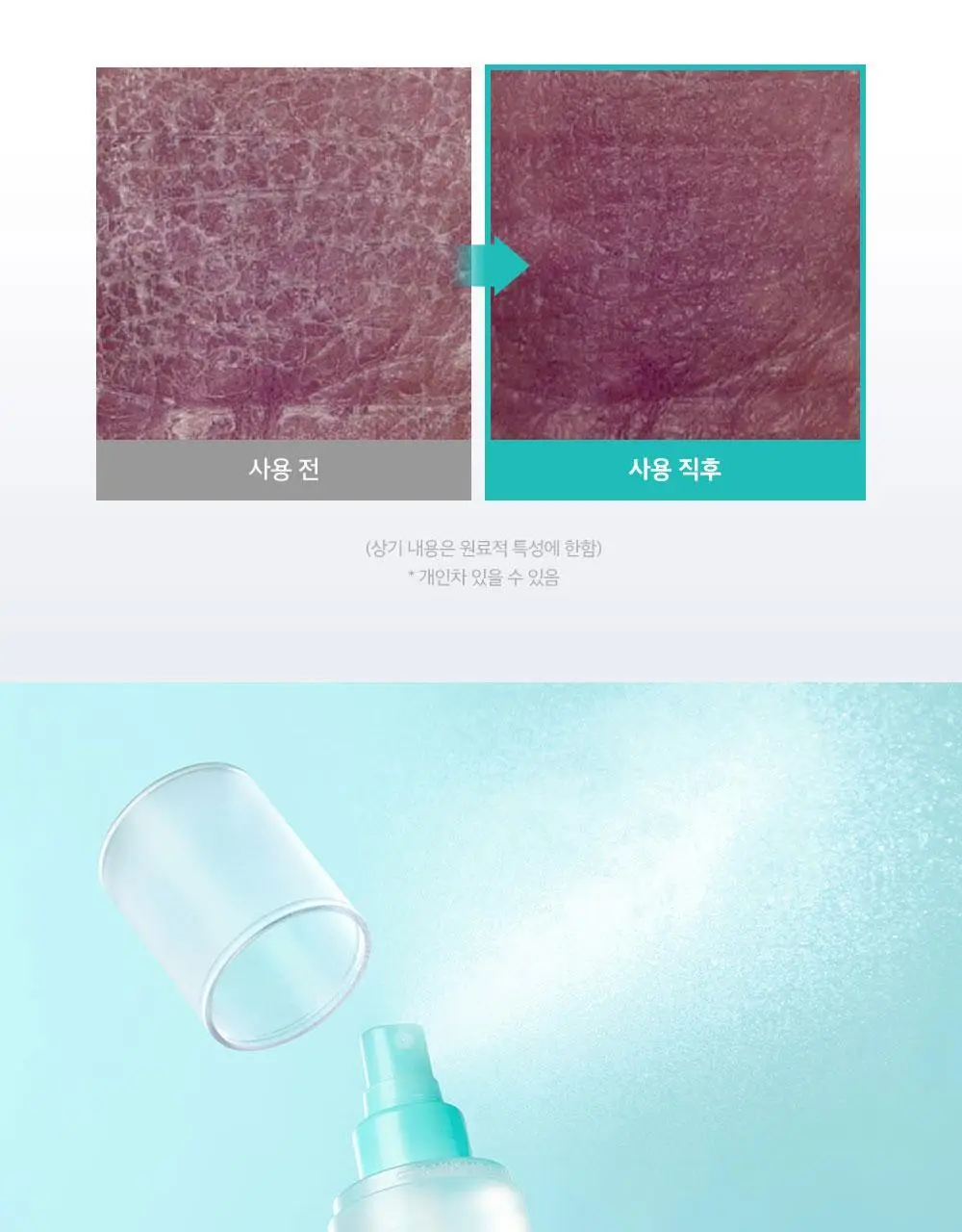 [등드름개선/흔적]더마비 AC컨트롤 바디미스트 200ml 상세페이지 17